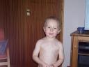 Chicken Pox strikes