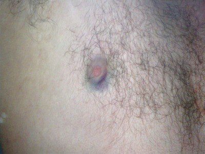 My blue nipple!