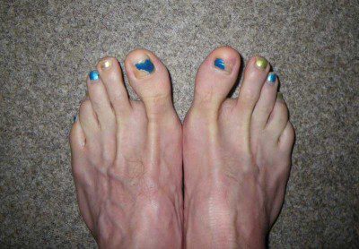 Matching Feet