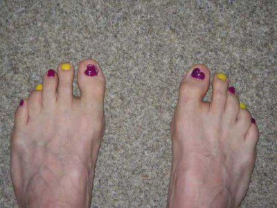 Racing Toes