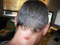 Sore Neck Sore Neck