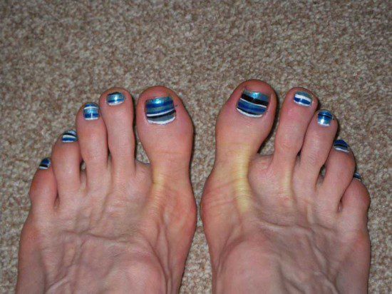 Blue Stripey Toenails