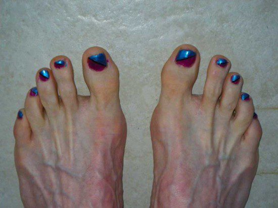 Race Toes