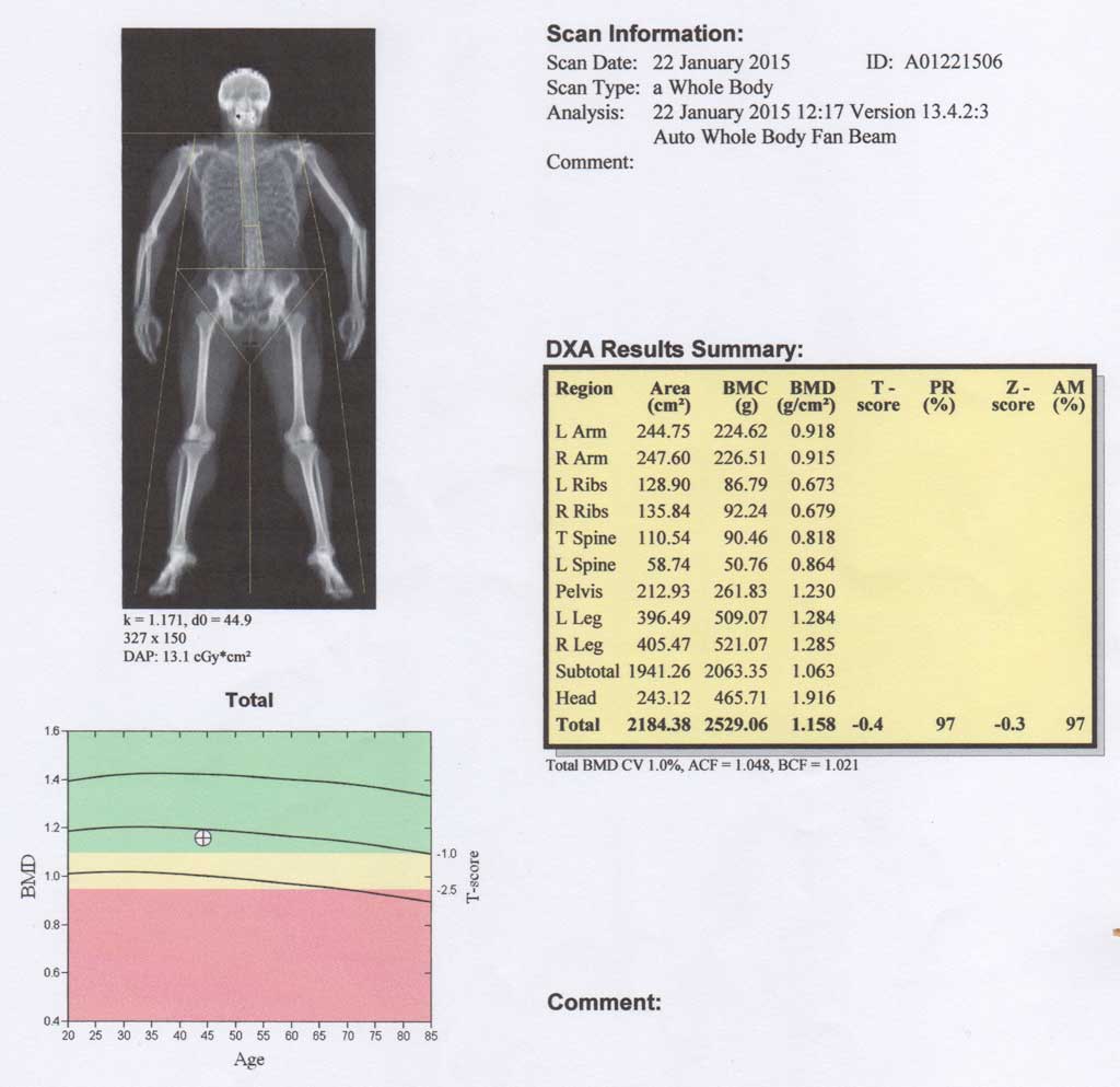 DEXA Scan - Scores & Everything You Need to Know