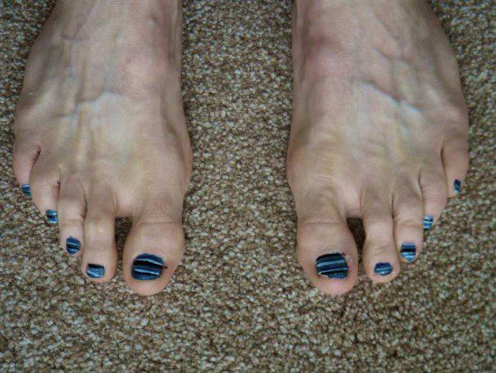 Stripey Blue Toenails