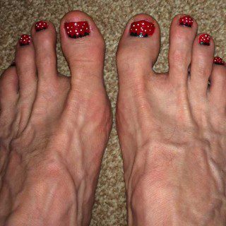 Fruity Toenails