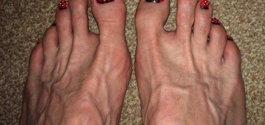 Fruity Toenails