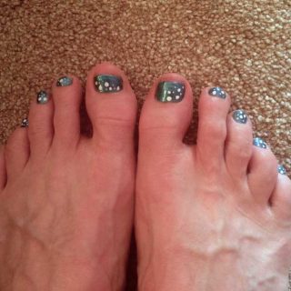 Spotty Toes