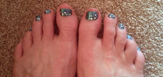 Spotty Toes
