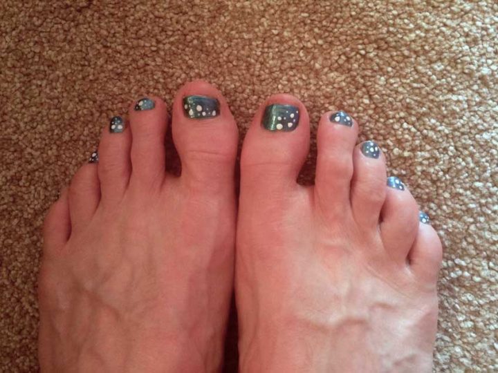 Spotty Toes
