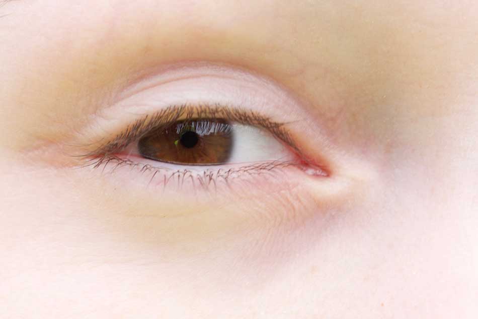 Morgans Eye