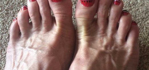Watermelon Toes