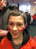 Rosy Cheeks